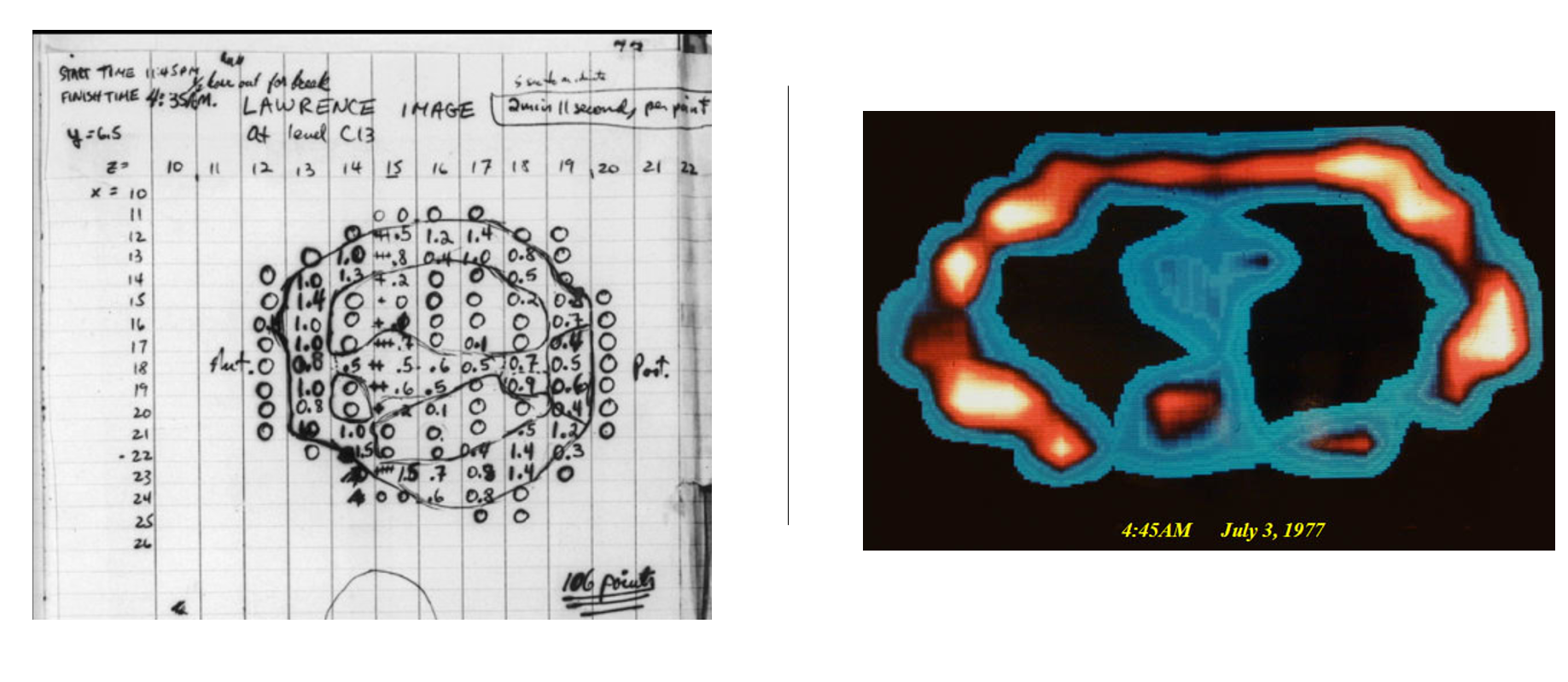 ../../_images/damadian_first.png
